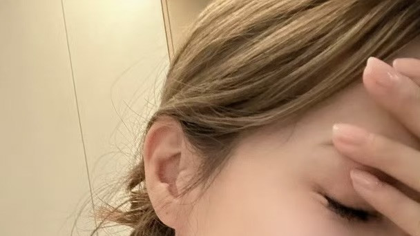 担心！TVB实力女星自曝弄伤眼角膜，因小事酿意外被自己蠢哭