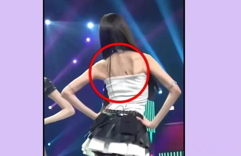 越来越多明星瘦过头！气色不好显病态上镜没精神，年纪大了更显老