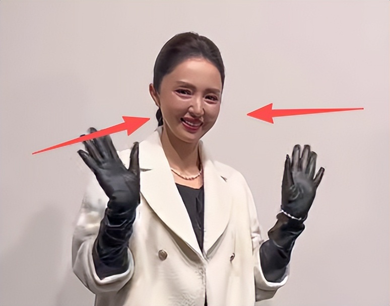 上海时装周，褶子多脸僵又肿、戴假发的董璇，被整容脸网红抢了镜