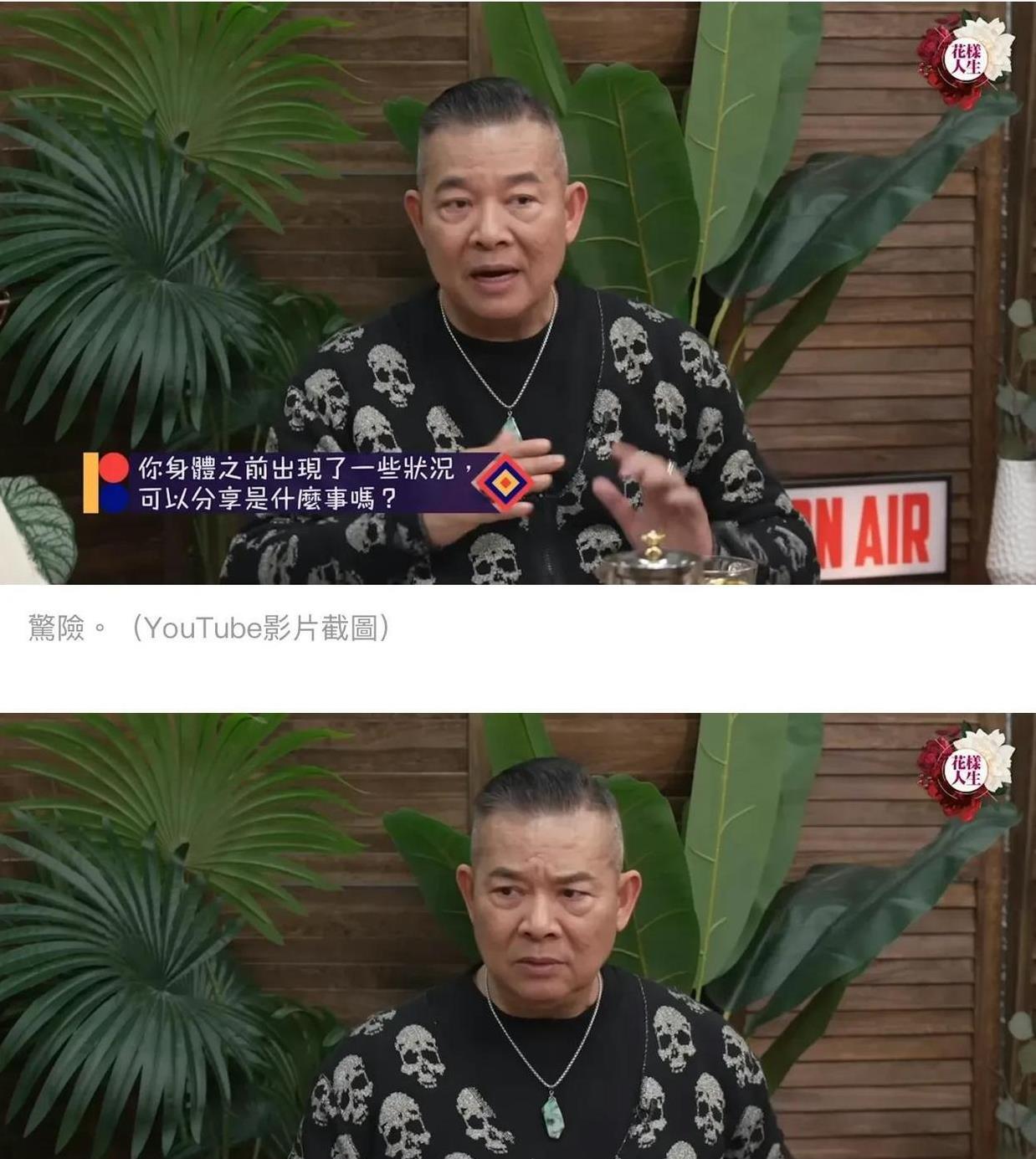 香港资深影星险丧命，大动脉撕裂，直言痛不欲生