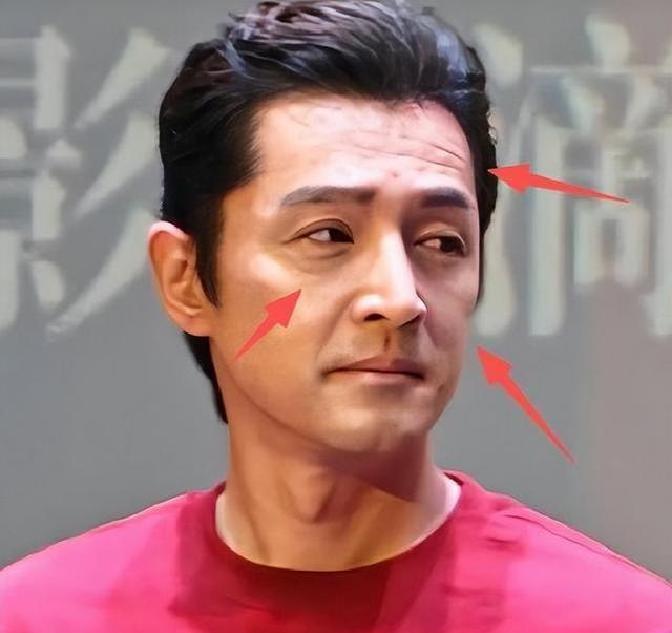 比整容还离谱!39岁江疏影露面,脸僵似硅胶,变化让人唏嘘