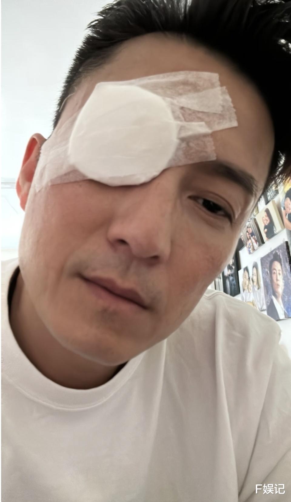 陈山聪晒眼睛做完手术自拍 亲自解释宣传活动上“藐视”粉丝原因