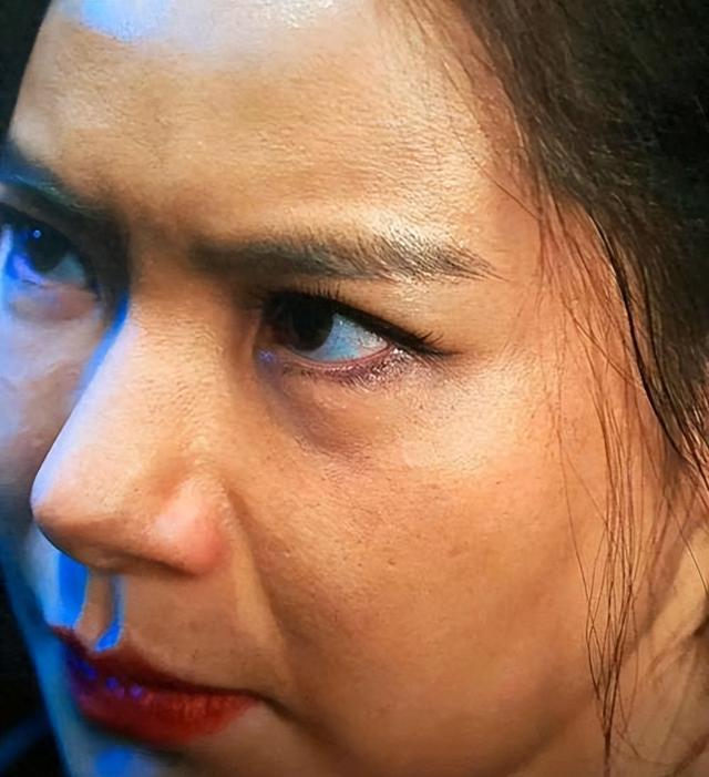 41岁女艺人戚薇"上节目眼睛变形",本人回应:肉毒素打多了