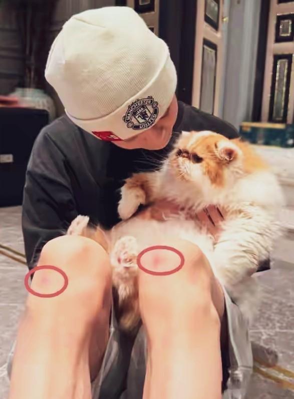 鹿晗豪宅休养膝伤触目惊心，昔日顶流为情所困至此？