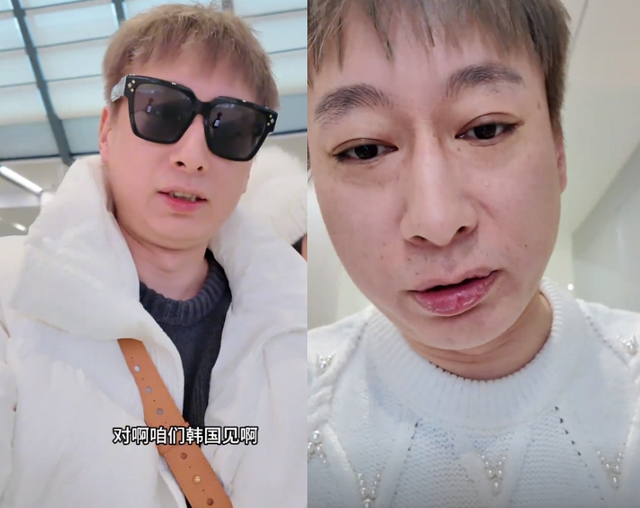 宋玉希夫妻晒医美后状态,网友直呼没眼看,应了那句先变鬼再变美