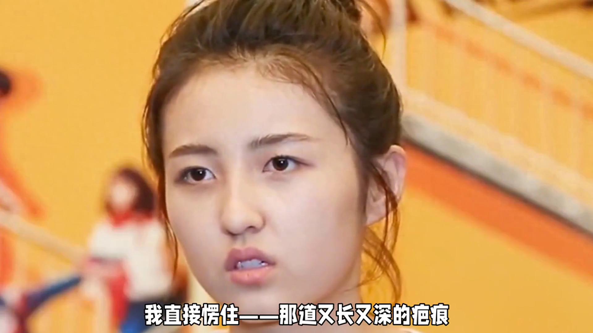 张子枫手臂惊现大块疤痕，令人心疼