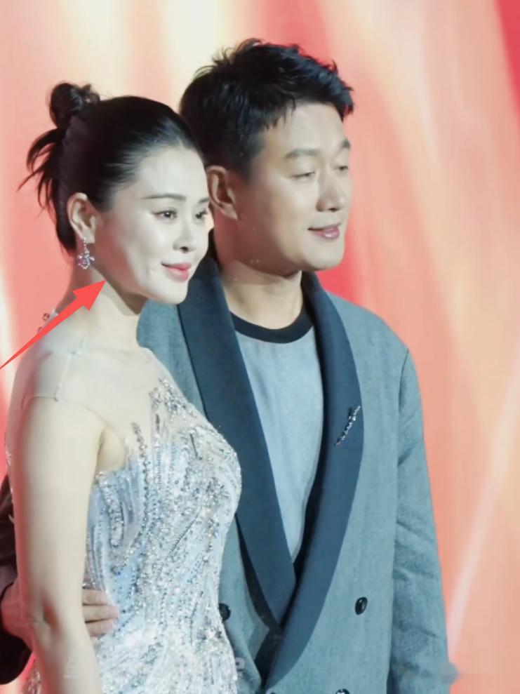 盛典上，孙怡小动作心机，张予曦超绝腰臀比，被佟大为流浪裤抢镜