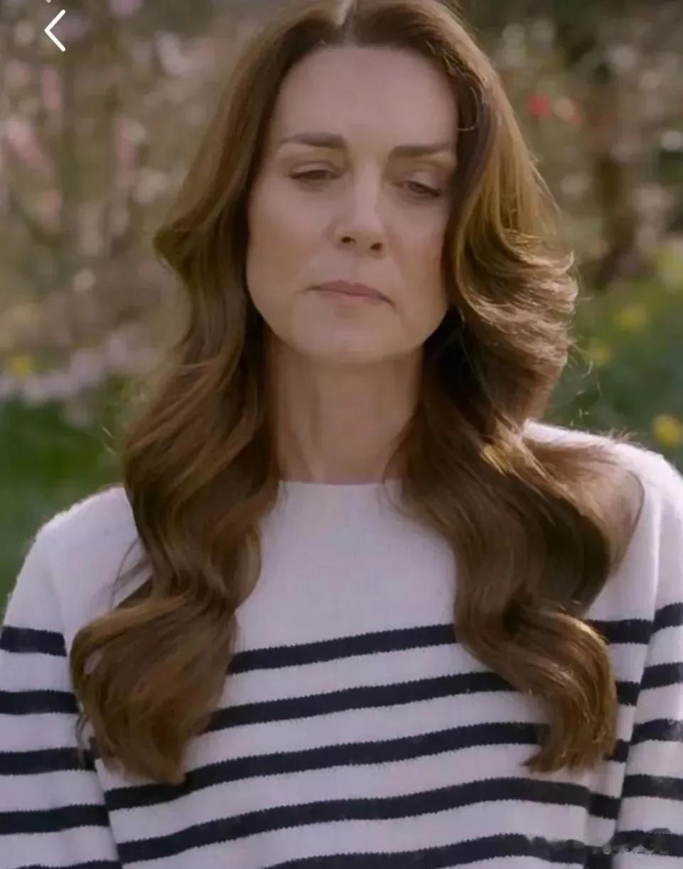 凯特王妃接孩子放学被拍，植发痕迹清晰可见，患癌后状态变化明显