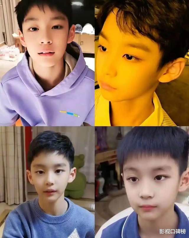 邓超一家外出,14岁等等瘦成“竹竿”,右腿一瘸一拐疑似受伤