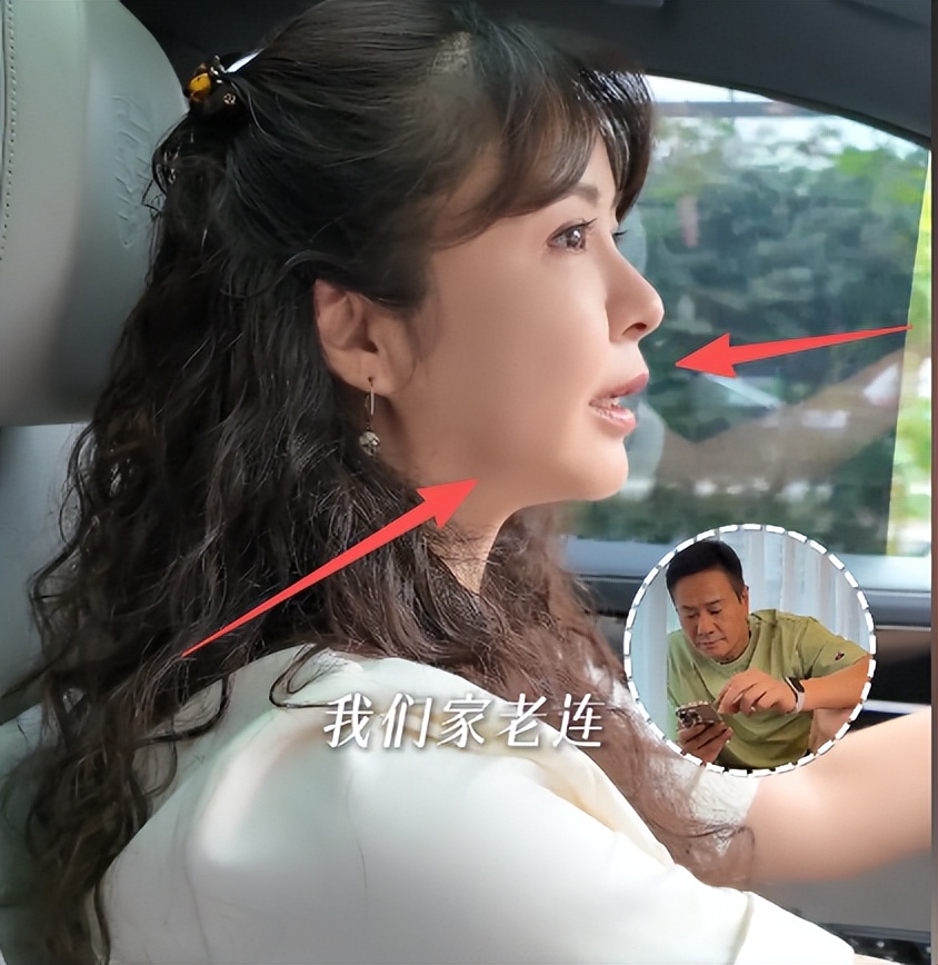 53岁连奕名带老婆唱戏！杨若兮脸馒化严重、苹果肌肿胀，撞脸蔡明