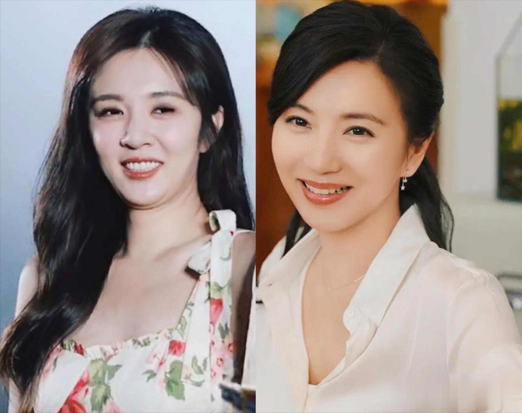 王晓晨医美过度颜值崩塌，陈好从容老去美上热搜，网友：完胜！