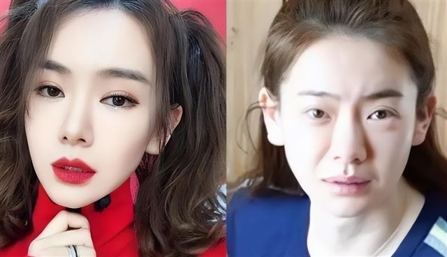 做了筋膜提升还未恢复就出来营业?戚薇参加综艺被嘲撞脸董明珠