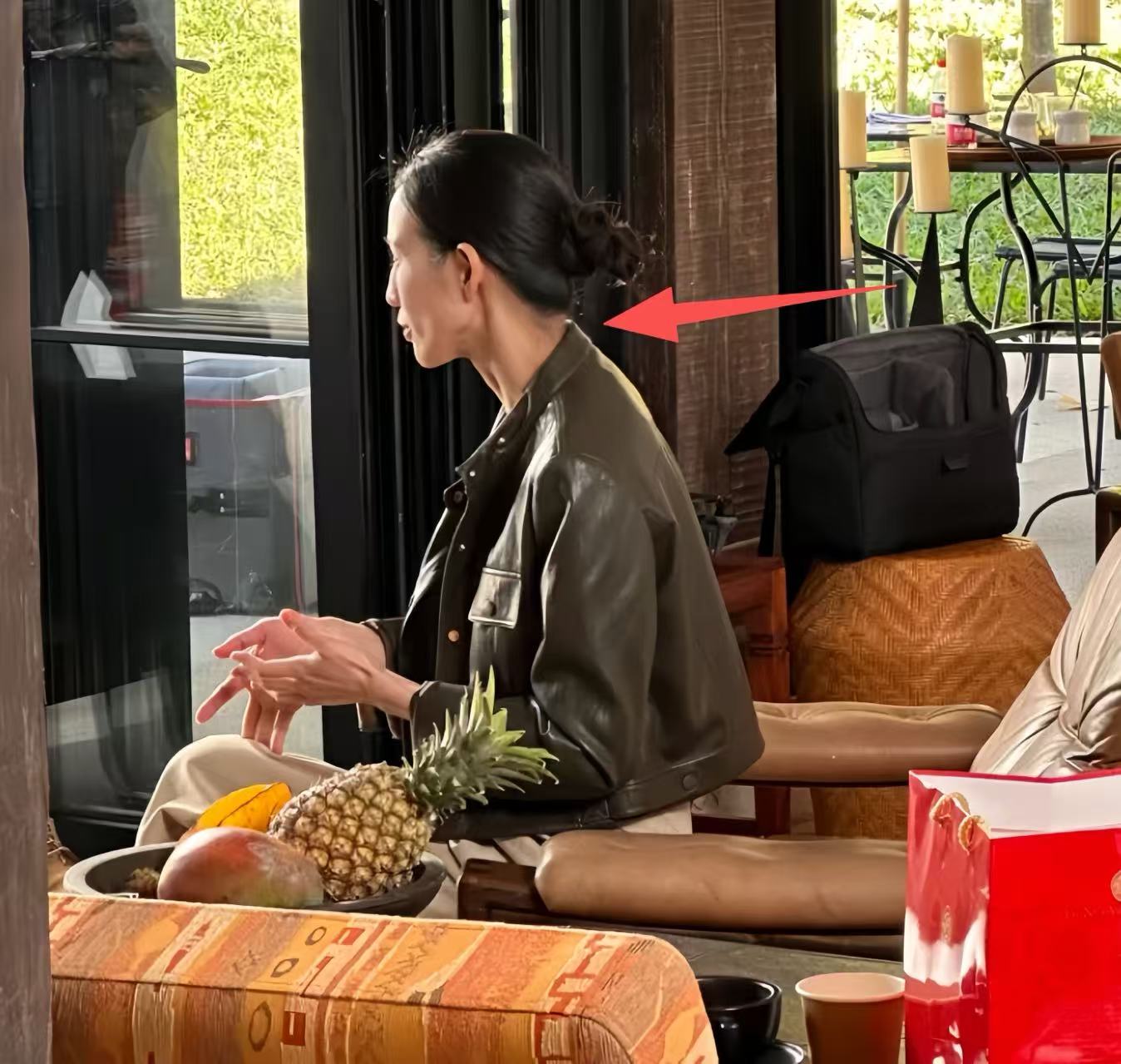 张钧甯近照暴瘦脱相！苹果肌下垂脸颊凹陷，脖子前倾严重体态怪异