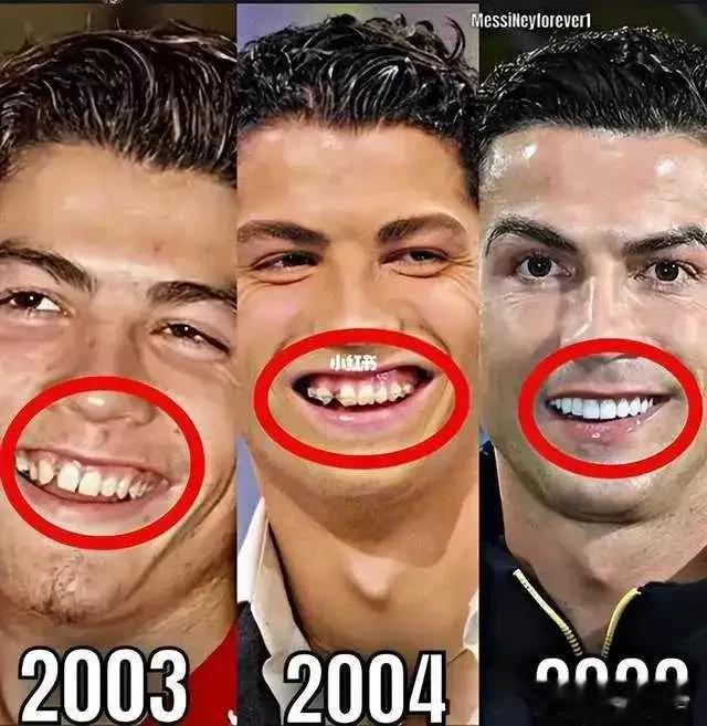 够狠!C罗为整容打断鼻梁 美国顶级整形医生:他面部基本都动过!