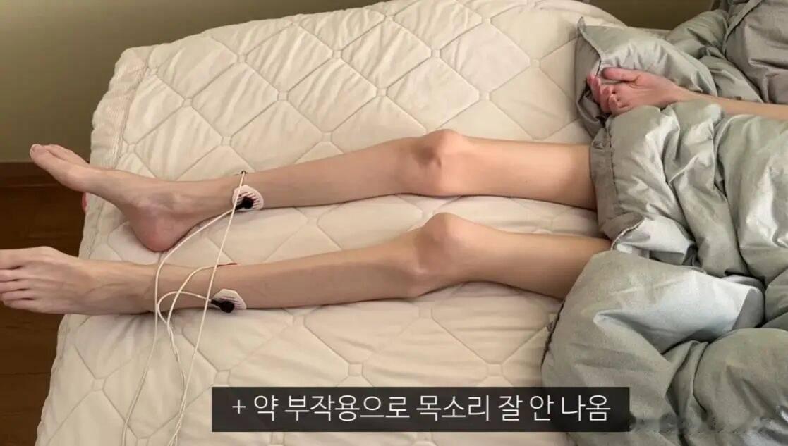 韩国女艺人金慧郁因患肾癌去世，年仅28岁，离世前瘦到只剩皮包骨