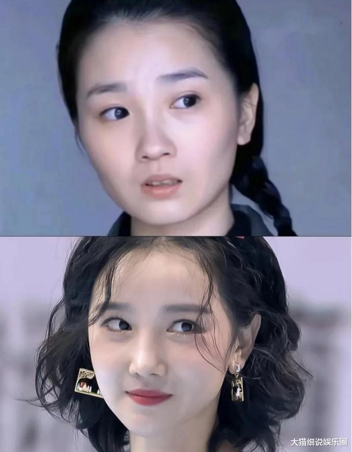 金晨的脸又又又升级了,鼻子不尖了,就是有点歪