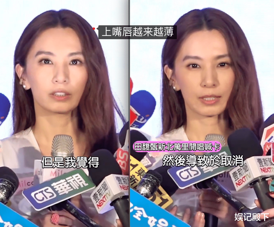 一年间像老了十岁，田馥甄近照下颌骨消瘦缩短，说话时嘴包不住牙