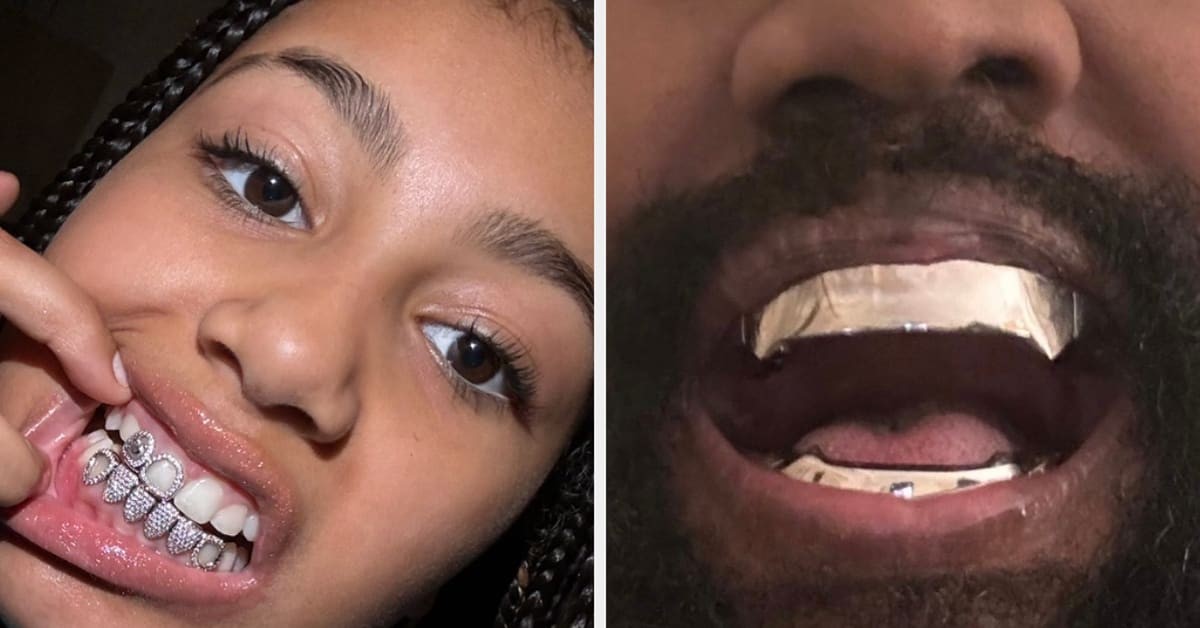 12岁小西北在整自己上越走越远，镶钻牙套上下各种穿孔贴文身？