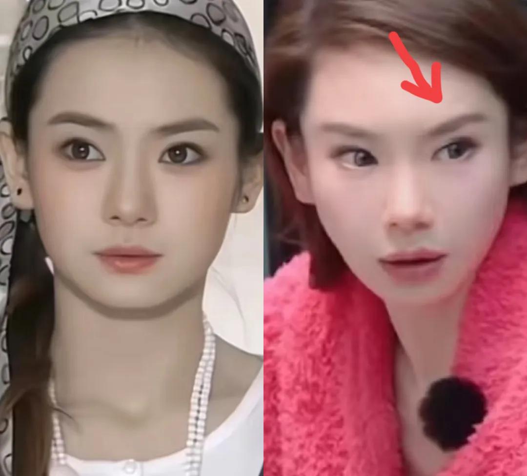 比整容还离谱！39岁江疏影现身活动，脸僵似硅胶，造型丑到认不出