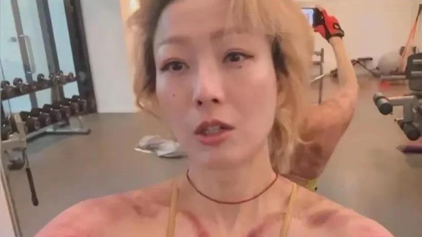 刮痧减重！53岁郑秀文刮痧后健身照片被曝，网友纷纷惊呼太震撼！