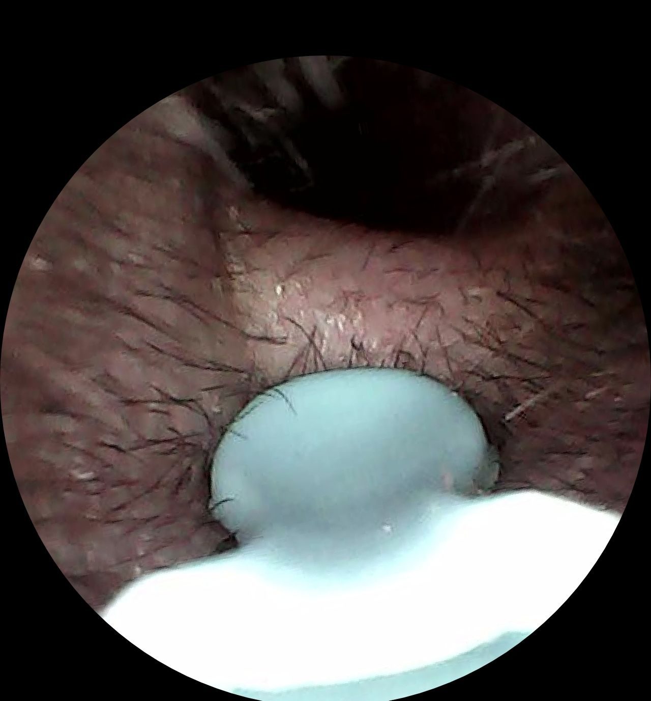 挖耳的科技感，安全還可視化，西圣Find X可視挖耳勺使用體驗來了