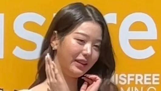 21岁张元英医美后遗症爆发！最新露面又油又肿，山根粗壮脸部扁平