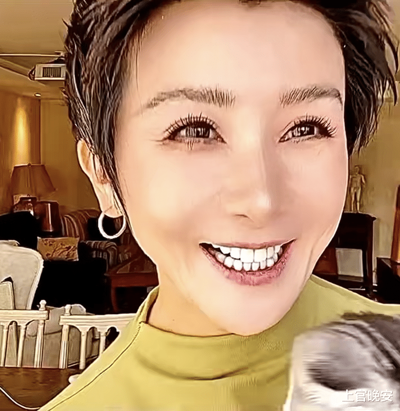 孙菲菲分享动态，脸又变了，面部僵硬紧绷下巴突兀，完全认不出
