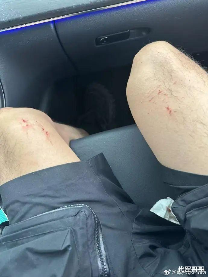 戴燕妮巴黎遇破窗抢劫，曾经遭遇抢劫的明星还有谁？