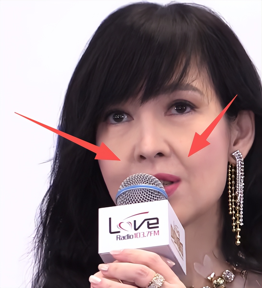 周慧敏罕露面，满脸皱纹如70岁老太，一口黄牙抢镜，女神滤镜全无