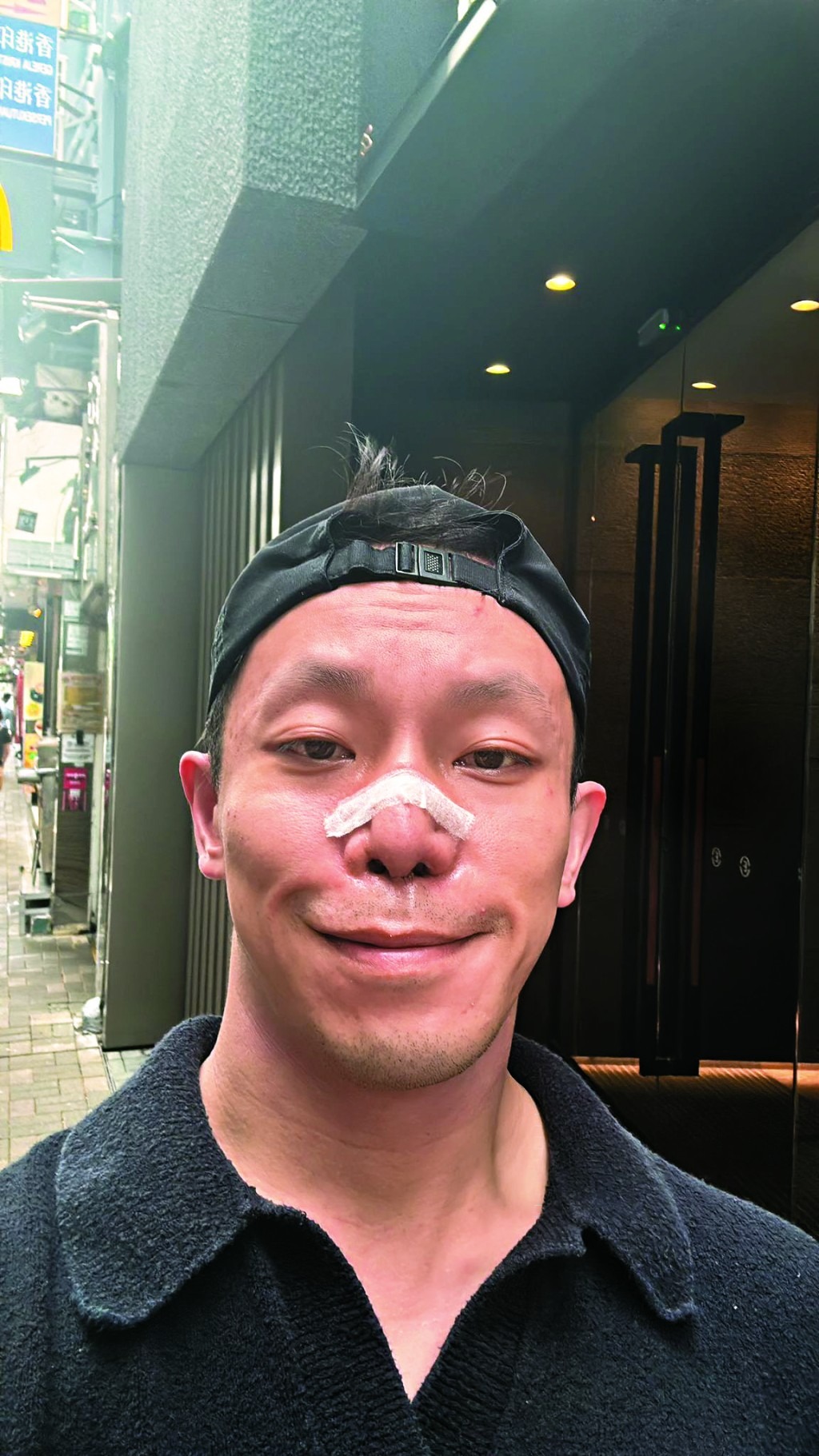 香港富二代遭车祸严重毁容,近照面目全非,曾找十多位医生修复