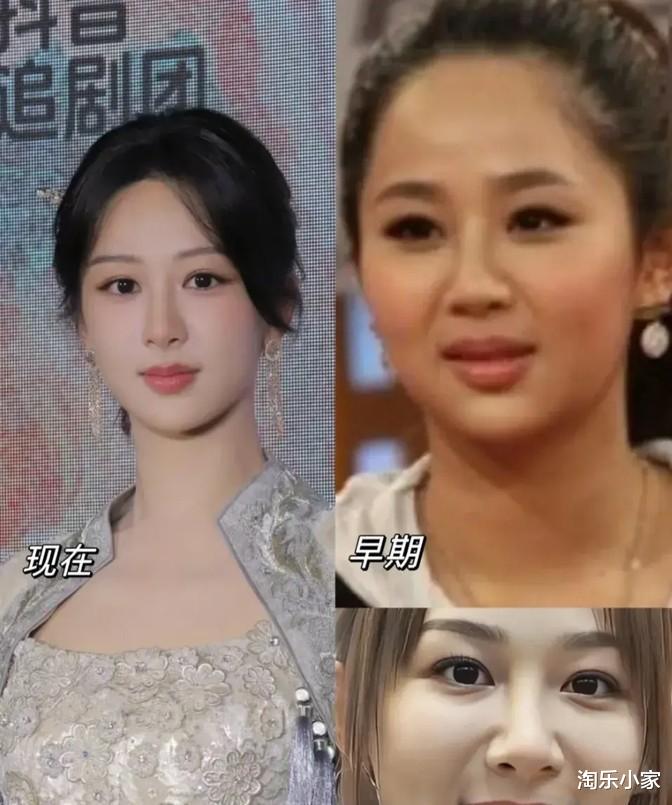 苹果肌发光、下颌角消失！杨紫被嘲医美过度，是观众苛刻还是行业畸形？