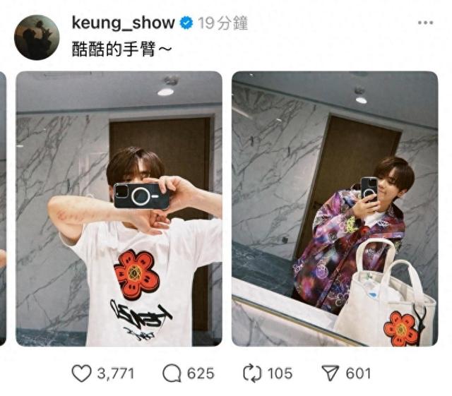 姜涛堕海 | 姜涛手部伤势曝光，两前臂伤疤逾20个：酷酷的手臂