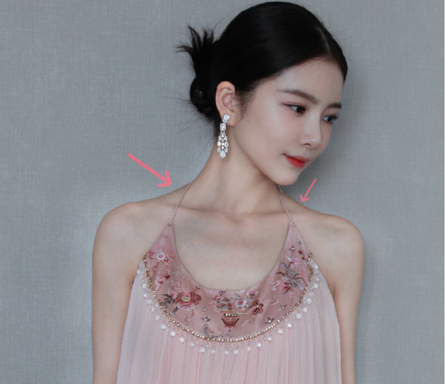 杜淳妻子医美翻车,触目惊心,吓坏3亿网友