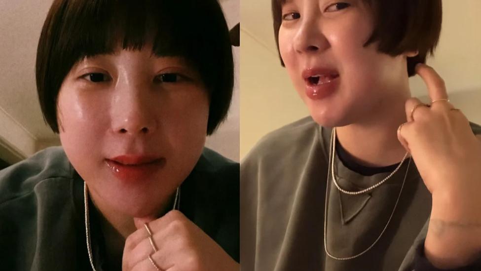 韩国女爱豆徐仁英自曝因“胖了20斤和整容后遗症”苦恼不已