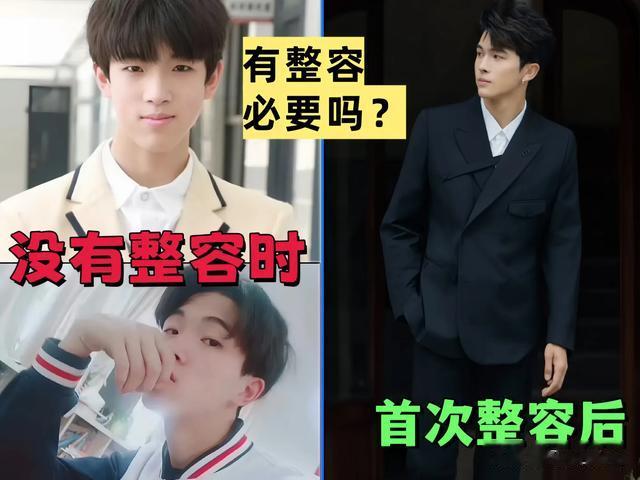 韩安冉老公再次去整容，原因是怕韩安冉被别的小奶狗拐走？