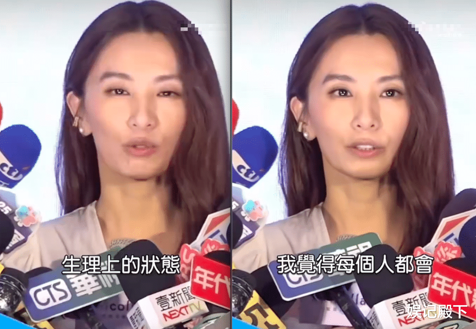 一年间像老了十岁，田馥甄近照下颌骨消瘦缩短，说话时嘴包不住牙