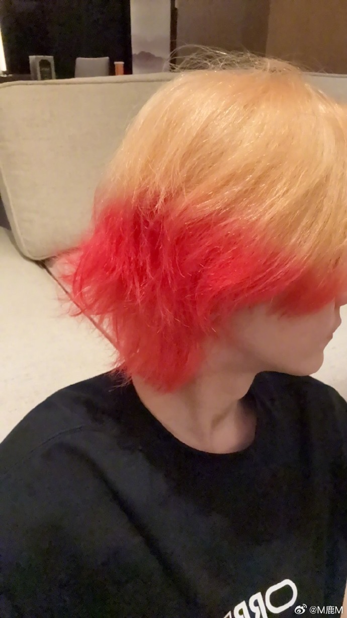 鹿晗发博晒自拍,左臂现淤青