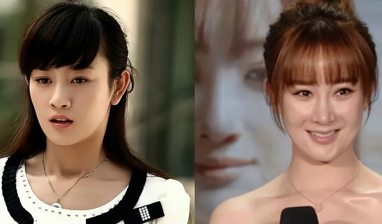 张檬夫妻带儿子赏秋!产后8月坚持母乳,脸僵又老整容后遗症显现