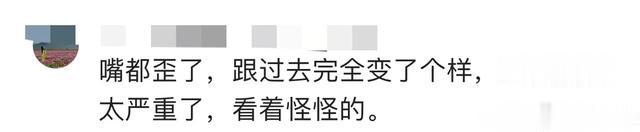 50岁金巧巧疑医美过度嘴歪，扎高马尾扮嫩土气，终于可以演村妇了