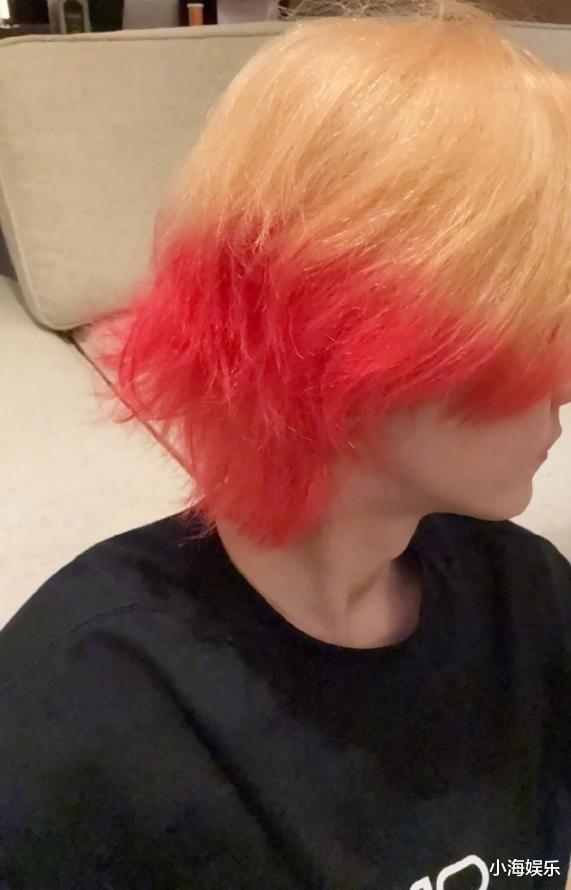 鹿晗解封后首发动态，手臂淤青引发猜测，一周涨粉四百万呢