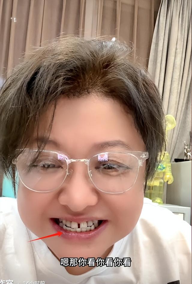 韩红又瘦了！为开全球演唱会减肥不吃肉，豁了几十年的牙缝也补了