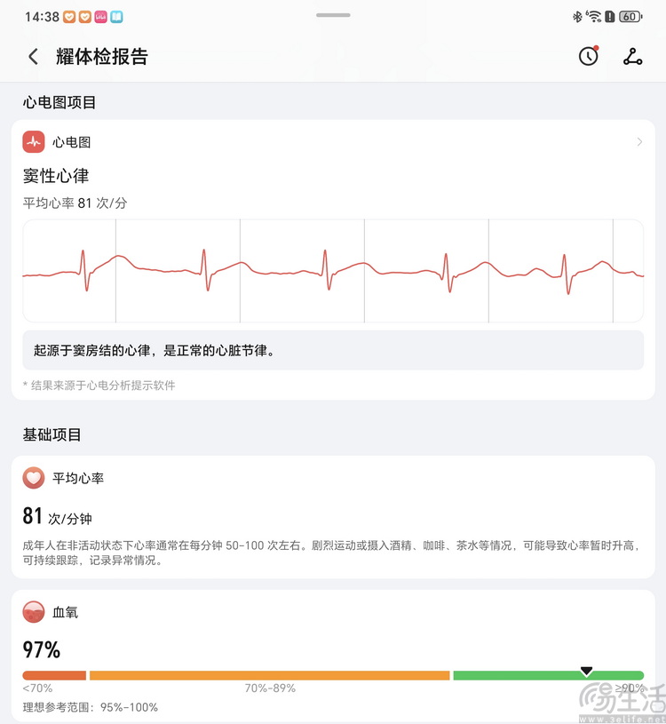 荣耀手表5 Ultra评测:有“钛”度的高端健康表