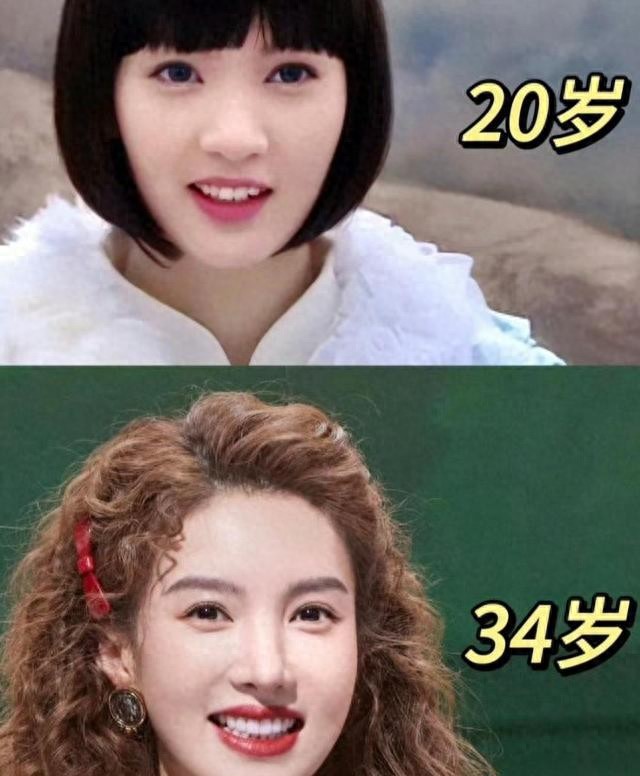 万万没想到，沉迷于医美的金晨变成了这样，她走到这步怪不了别人