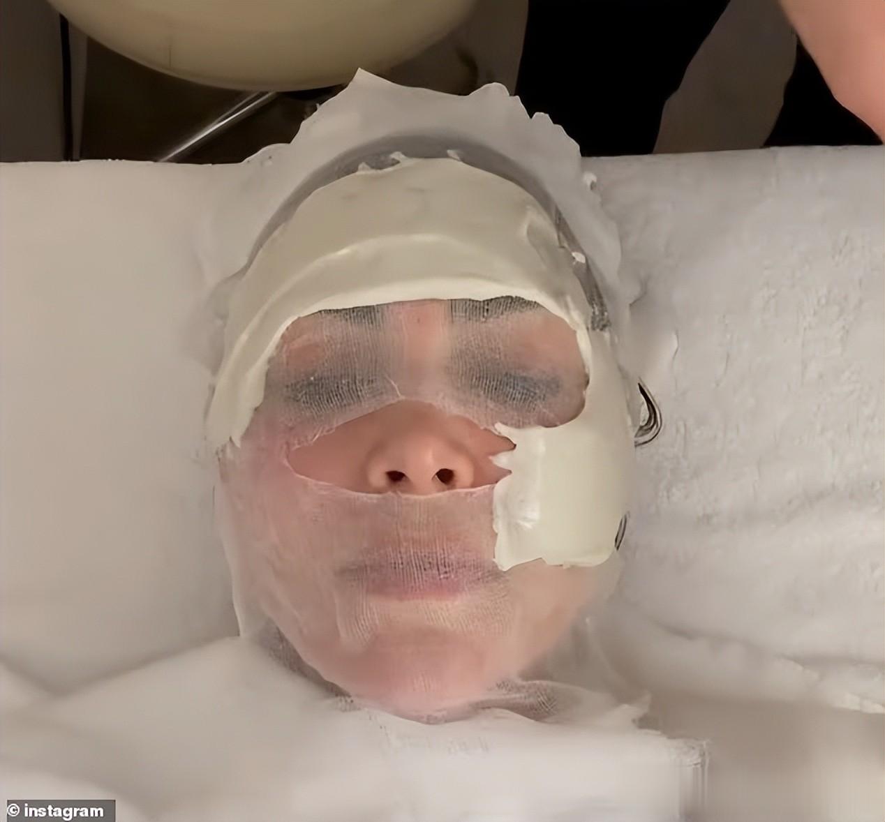 金·卡戴珊也赴韩Do脸,晒素颜照脸部状态不好,做完效果立竿见影