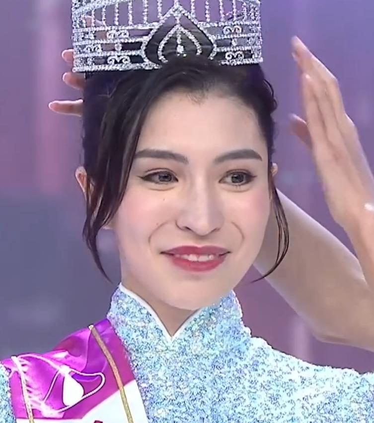 “2025港姐季亚冠”丑出新高度！冠军嘴歪大龅牙，身高更似武大郎