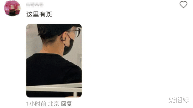 宋丹丹逛街走特别快,不像逛街像锻炼身体,脖子抢镜有好大一片斑