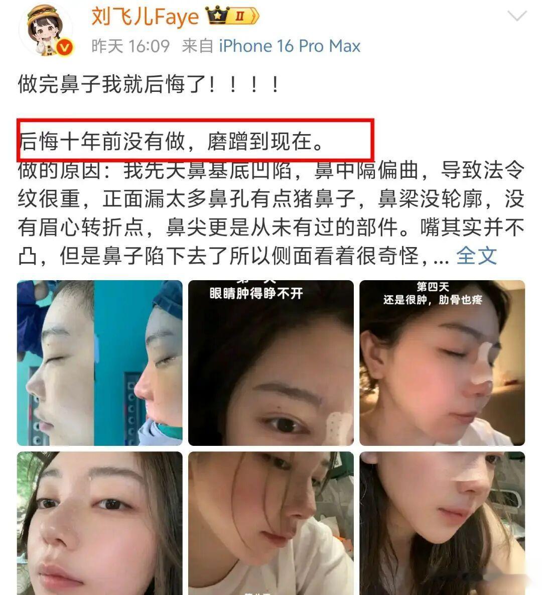 刘飞儿整容后首次直播,自曝手术后坐飞机被拦!网友:没之前好看