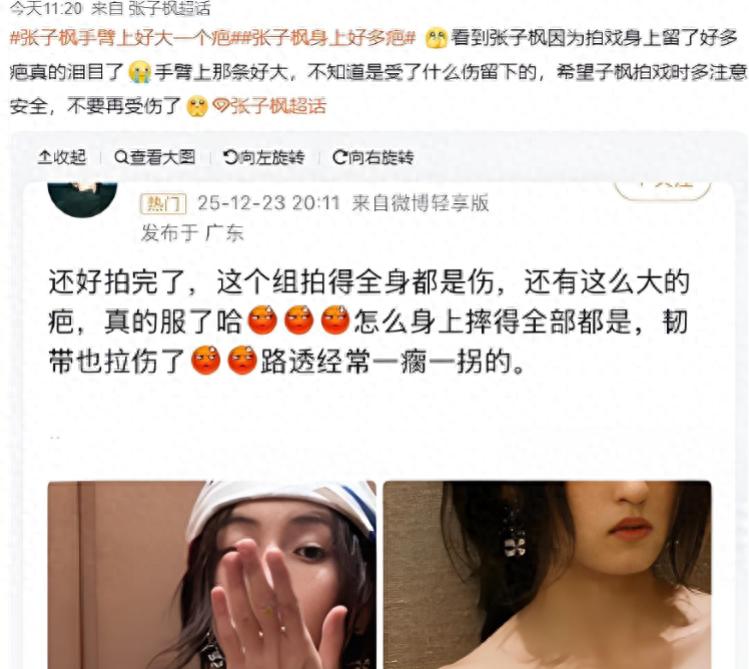 消失半年的张子枫，身上多了伤疤，眼神也变了，成龙当时没说错