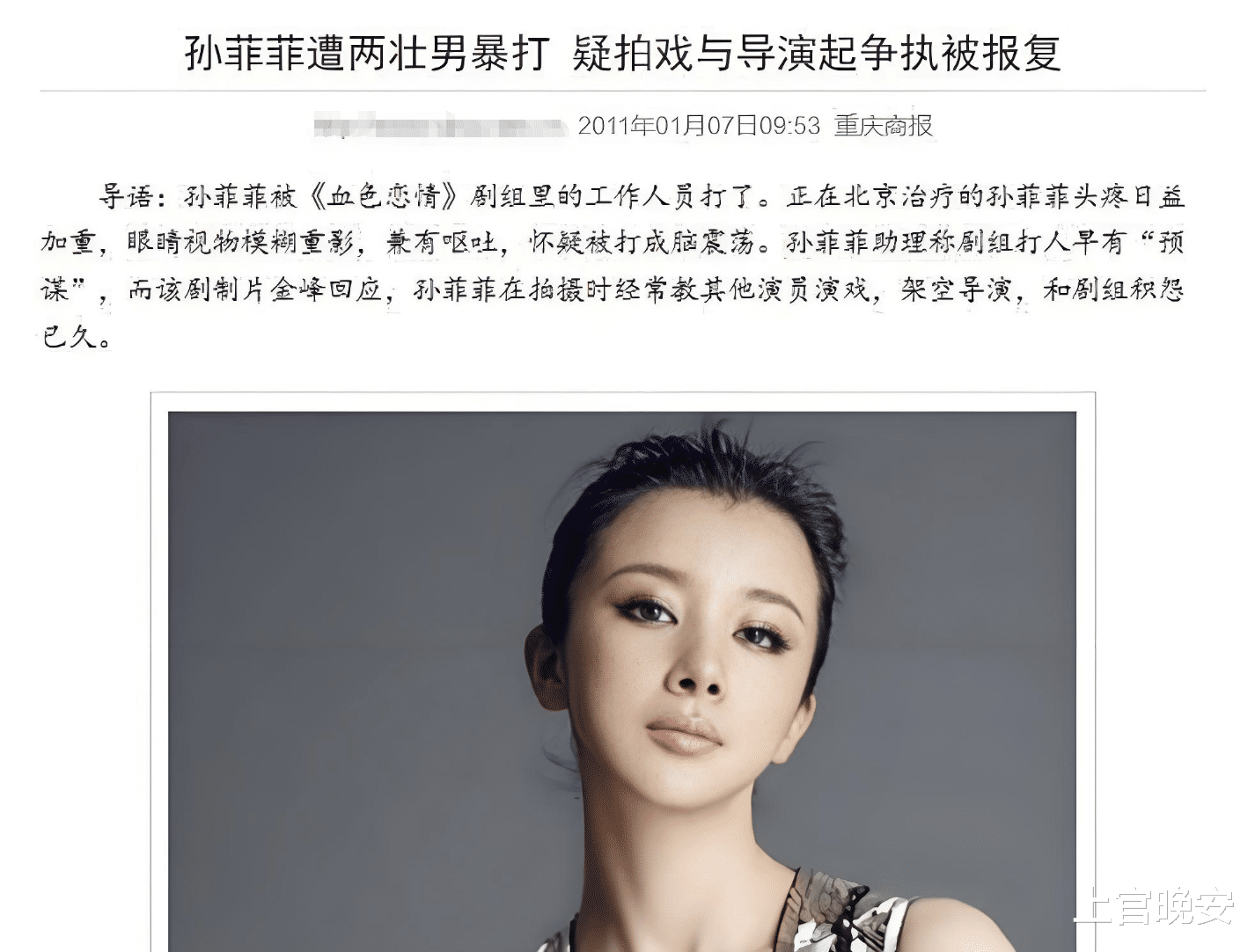 孙菲菲分享动态，脸又变了，面部僵硬紧绷下巴突兀，完全认不出