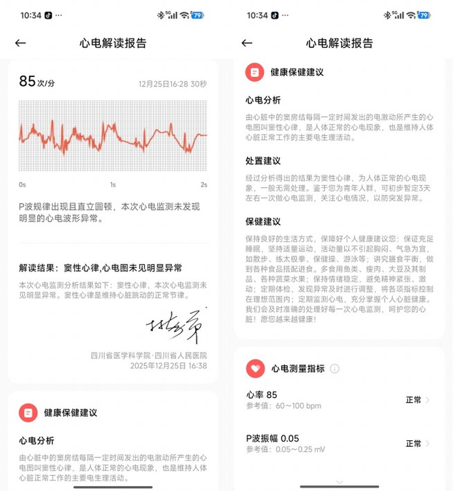 Xiaomi Watch 5評測：打響指控家電，重新定義智能手表交互